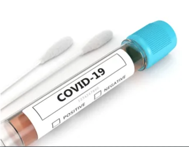Coronavirus Home Testing Kit